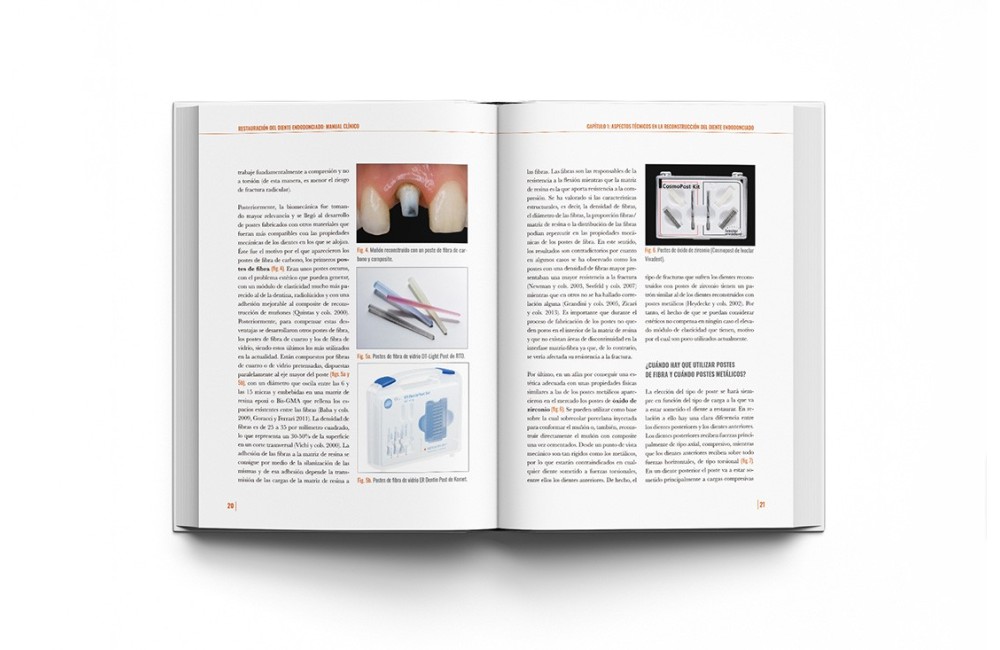 Restauración del Diente Endodonciado Manual...