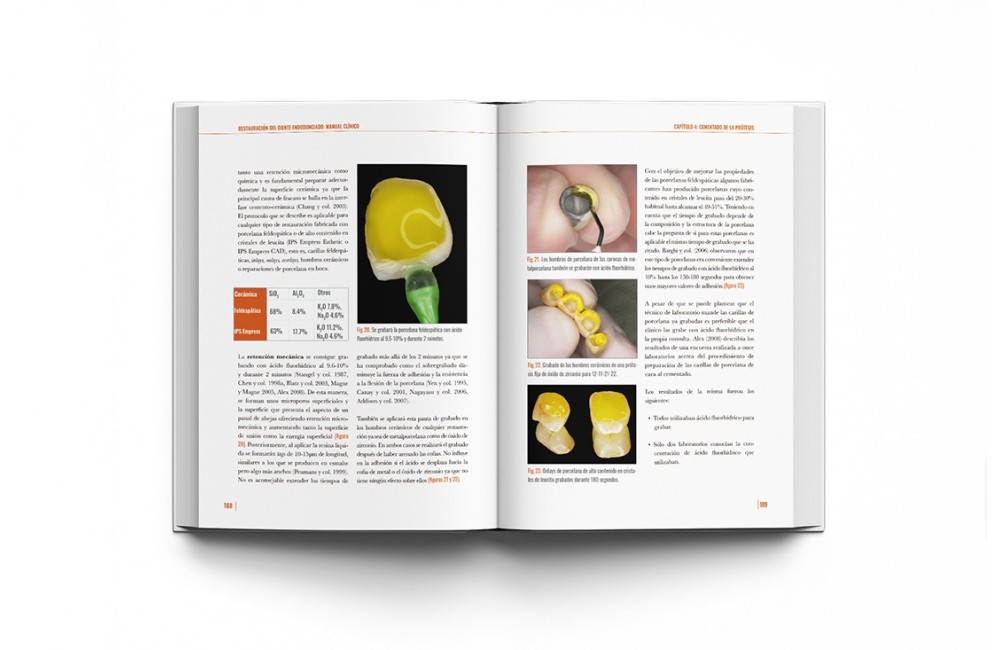 Restauración del Diente Endodonciado Manual...