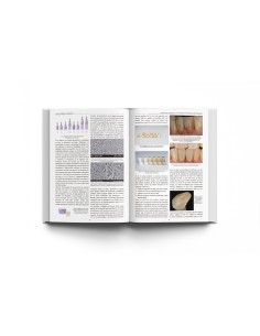 Las Claves de la Prótesis Fija en Cerámica - Ernest Mallat Callís / Juan Cadafalch Cabaní / Javier de Miguel Figuero - Lisermed 2