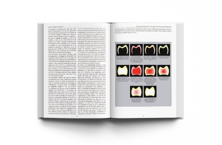 Las Claves de la Prótesis Fija en Cerámica
