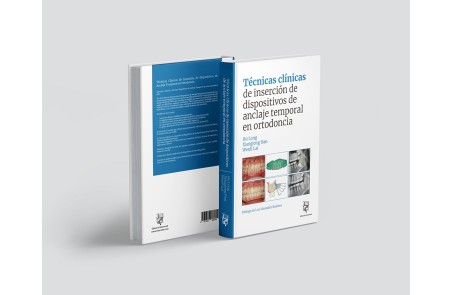 Técnicas clínicas de dispositivos de anclaje temporal en ortodoncia