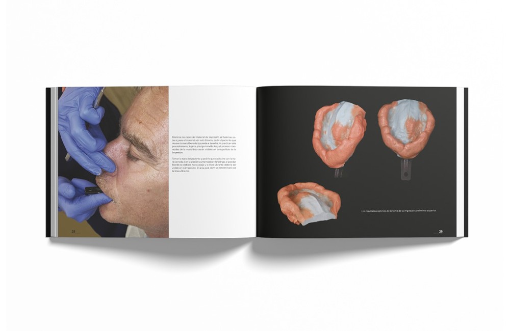 Sistema de Prótesis Biofuncional (BPS)® Paso a...