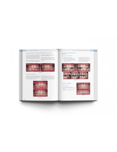 RNO. La otra cara de la Odontología - Lisermed 2