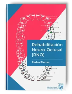 Rehabilitación Neuro-Oclusal (RNO)