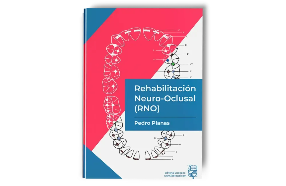 Rehabilitación Neuro-Oclusal (RNO)