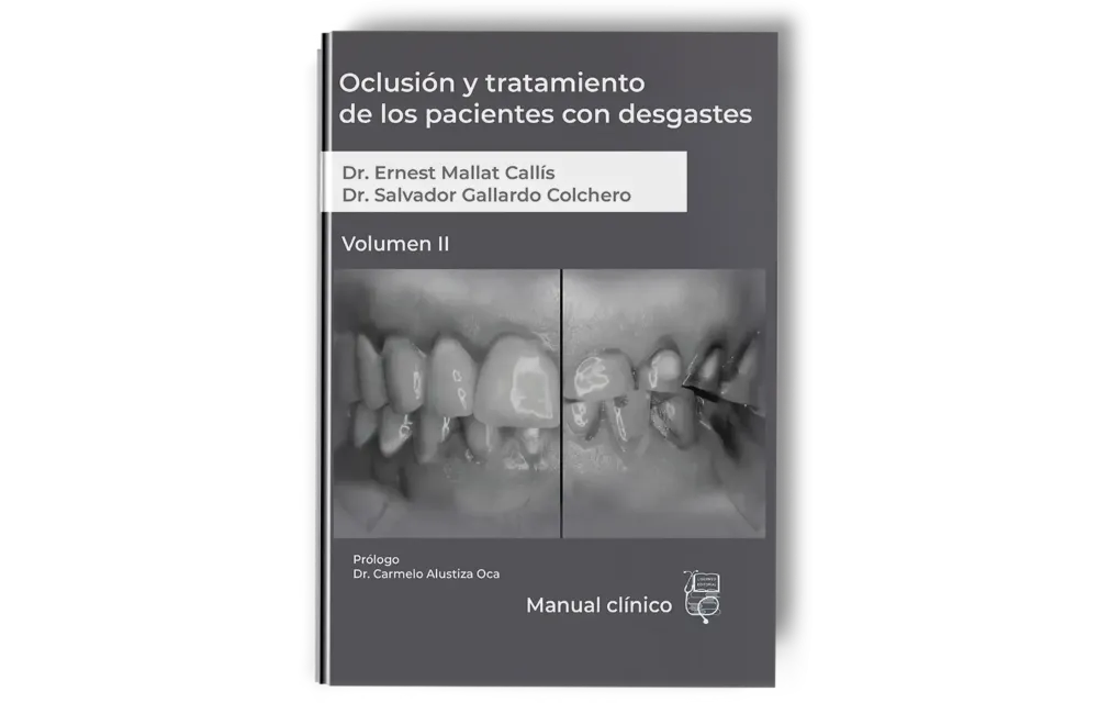 Oclusión y Tratamiento de los Pacientes con Desgastes. Volumen 2 - Ernest Mallat - Lisermed