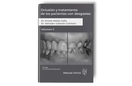 Oclusión y Tratamiento de los Pacientes con Desgastes. Volumen 2 - Ernest Mallat - Lisermed