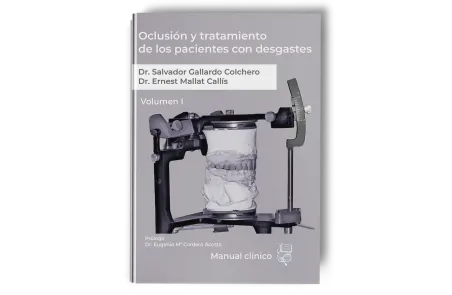 Oclusión y Tratamiento de los Pacientes con Desgastes. Volumen 1 - Ernest Mallat - Lisermed