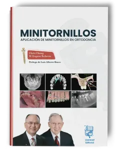 Minitornillos. Aplicaciones clínicas en ortodoncia