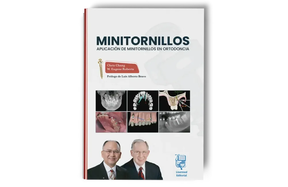 Minitornillos. Aplicaciones clínicas en ortodoncia